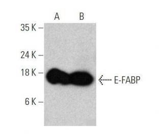 western blotting image from recommended E-FABP (A-9) monoclonal antibody replacement. Image 358627