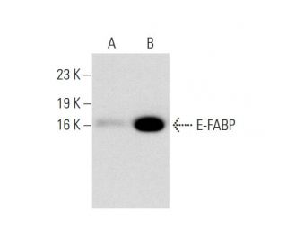 E-FABP Antibody (B-3) - Western Blotting - Image 138487