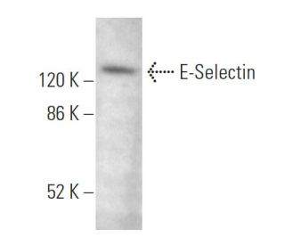 E-Selectin/CD62E/SELE Antibody (1.2B6) - Western Blotting - Image 374916 