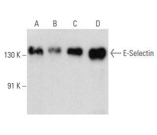 E-Selectin/CD62E/SELE Antibody (2Q780) - Western Blotting - Image 358399 