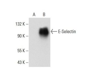 E-Selectin/CD62E/SELE Antibody (A-10) - Western Blotting - Image 59587