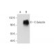 E-Selectin/CD62E/SELE Antibody (A-10) - Western Blotting - Image 59587