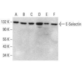 E-Selectin/CD62E/SELE Antibody (D-7) - Western Blotting - Image 377628 