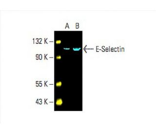 E-Selectin/CD62E/SELE Antibody (D-7): m-IgG Fc BP-HRP Bundle