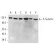 western blotting image from recommended E-Selectin/CD62E/SELE (D-7) monoclonal antibody replacement. Image 377628