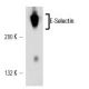 E-Selectin/CD62E/SELE Antibody (HAE-If) - Western Blotting - Image 14960