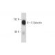 E-Selectin/CD62E/SELE Antibody (P2H3) - Western Blotting - Image 127975