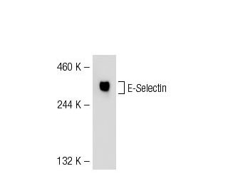 E-Selectin/CD62E/SELE Antibody (UZ6) - Western Blotting - Image 55306
