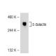 E-Selectin/CD62E/SELE Antibody (UZ6) - Western Blotting - Image 55306