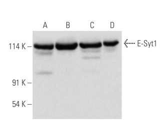 E-Syt1 Antibody (C-1) - Western Blotting - Image 319390 