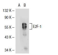 E2F1 Antibody (KH129) | SCBT - Santa Cruz Biotechnology
