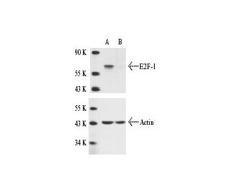 E2F-1 siRNA (h): sc-29297. Western blot analysis of E2F-1 expression in non-transfected control (A) and E2F-1 siRNA transf 