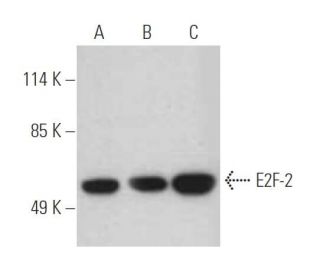 western blotting image from recommended E2F-2 (TFE-25) monoclonal antibody replacement. Image 395165