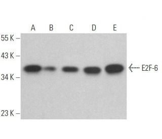 western blotting image from recommended E2F-6 (TFE61) monoclonal antibody replacement. Image 359081