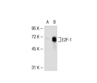 E2F1 Antibody (KH129) - Western Blotting - Image 53225 