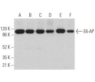 western blotting image from recommended E6-AP (E-4) monoclonal antibody replacement. Image 360143