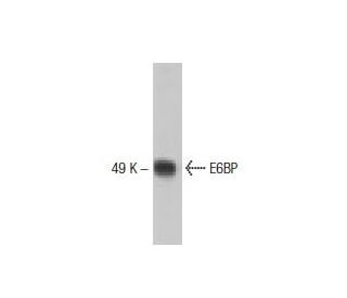 E6BP Antibody (30) - Western Blotting - Image 133342 