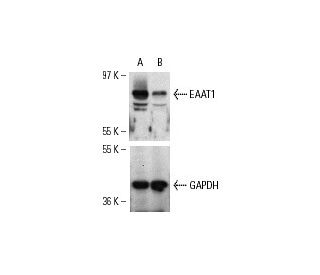 EAAT1 siRNA (h): sc-35253. Western blot analysis of EAAT1 expression in non-transfected control (A) and EAAT1 siRNA transf 