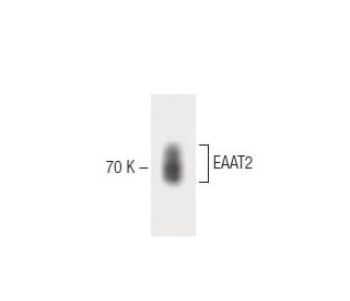 EAAT2 Antibody (20) - Western Blotting - Image 60288