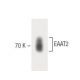 EAAT2 Antibody (20) - Western Blotting - Image 60288