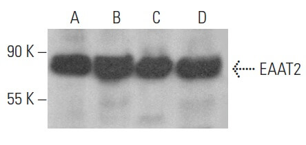 彩片 EAAT2 Antibody (E-1) | SCBT - Santa Cruz Biotechnology