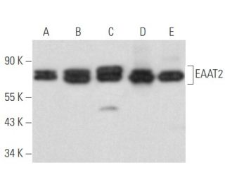 EAAT2 Antibody (E-1) - Western Blotting - Image 355827 