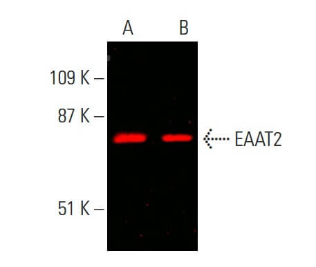 彩片 EAAT2 Antibody (E-1) | SCBT - Santa Cruz Biotechnology