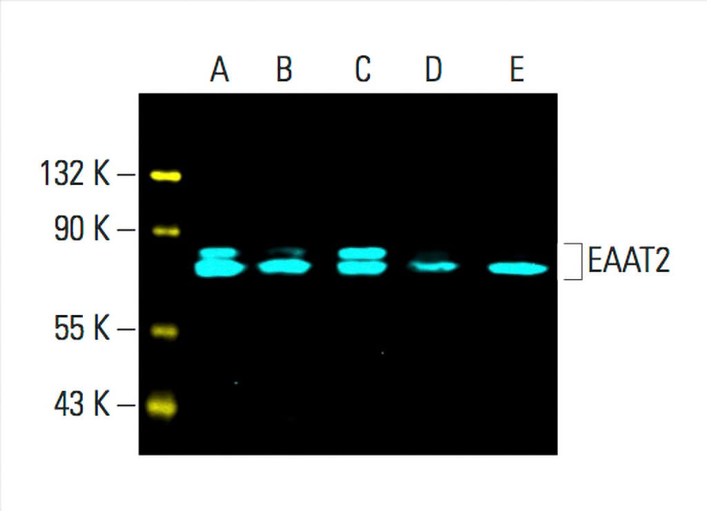 eaat2-antibody-e-1-western-