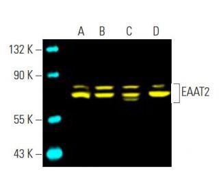 TOUKA様確認用 12 Kawasaki Ninja ZX6R Engine Motor Neutral Gear Position