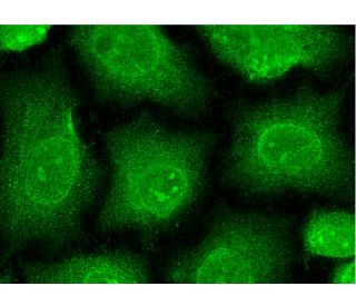 immunofluorescence image from recommended EAAT2 (E-1) monoclonal antibody replacement. Image 145471