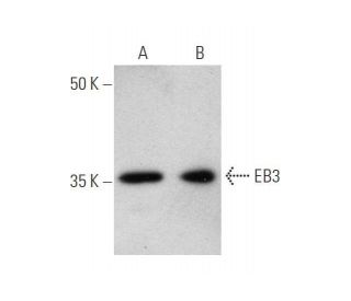 EB3 Antibody (7) - Western Blotting - Image 350860 