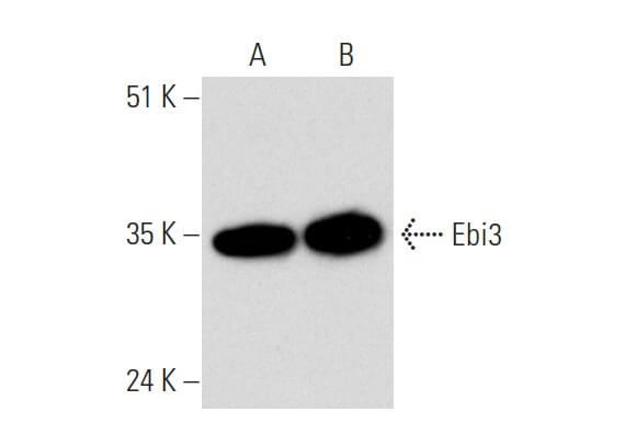 Ebi3 Antibody (F-7) | SCBT - Santa Cruz Biotechnology