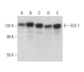 ECE-1 Antibody (A-6) - Western Blotting - Image 320025The Double Nickase Plasmid features a U6 promoter for sgRNA expression, a 20 nt targeting sequence, and a gRNA scaffold to guide Cas9n. It includes a CBh promoter for Cas9n (D10A) and puromycin resistance, GFP for transfection verification, and nuclear localization signals (NLS). The 2A peptide allows co-expression of Cas9n and Puro from a single promoter, enabling precise genome editing with reduced off-target effects.