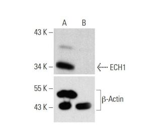 ECH1 HDR Plasmid (h): sc-406076-HDR. Western blot analysis of ECH1 expression in non-transfected control (A) and puromycinEach CRISPR/Cas9 Knockout (KO) Plasmid product consists of a pool of 3 plasmids designed to ensure identification and cleavage of a specific gene for maximum knockout efficiency. Each plasmid encodes a unique 20 nt sequence derived from the GeCKO (v2) library.