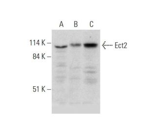 western blotting image from recommended Ect2 (G-4) monoclonal antibody replacement. Image 331196