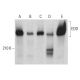This polyclonal antibody has been discontinued. See our recommended <a href="edd-antibody-b-11">EDD (B-11)</a> monoclonal antibody (sample data shown). western blotting image from recommended EDD (B-11) monoclonal antibody replacement. Image 382110