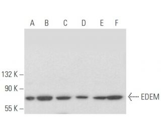 western blotting image from recommended EDEM (D-1) monoclonal antibody replacement. Image 355452