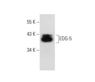 western blotting image from recommended EDG-5 (E-12) monoclonal antibody replacement. Image 301280