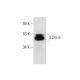 This polyclonal antibody has been discontinued. See our recommended <a href="edg-5-antibody-e-12">EDG-5 (E-12)</a> monoclonal antibody (sample data shown). western blotting image from recommended EDG-5 (E-12) monoclonal antibody replacement. Image 301280