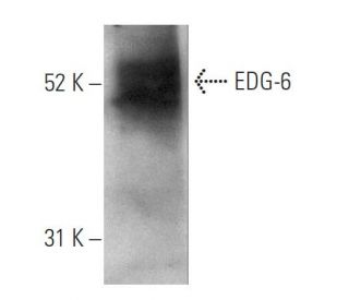 EDG-6 Antibody (1) - Western Blotting - Image 67418SAM Transcription Activation: SAM system utilizing dCas9-VP64, MS2-P65-HSF1, and sgRNA for precise gene transcription activation.