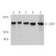 This polyclonal antibody has been discontinued. See our recommended <a href="eea1-antibody-g-4">EEA1 (G-4)</a> monoclonal antibody (sample data shown). western blotting image from recommended EEA1 (G-4) monoclonal antibody replacement. Image 373033