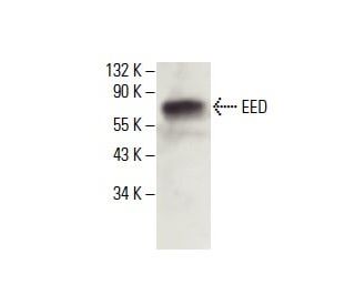 EED Antibody (B-3) - Western Blotting - Image 396353Each CRISPR/Cas9 Knockout (KO) Plasmid product consists of a pool of 3 plasmids designed to ensure identification and cleavage of a specific gene for maximum knockout efficiency. Each plasmid encodes a unique 20 nt sequence derived from the GeCKO (v2) library.