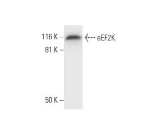 eEF2K Antibody (B-4) - Western Blotting - Image 295752 