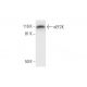 eEF2K Antibody (B-4) - Western Blotting - Image 295752 
