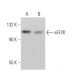 eEF2K Antibody (B-4) - Western Blotting - Image 374717