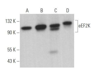 eEF2K Antibody (C-12) - Western Blotting - Image 362169 