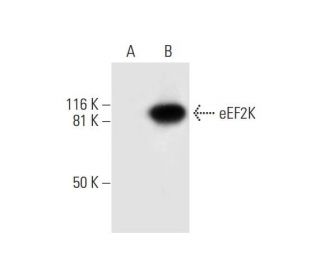 eEF2K Antibody (B-4) - Western Blotting - Image 294769