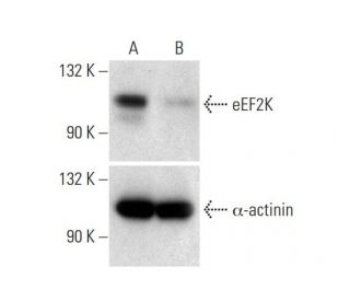 eEF2K Double Nickase Plasmid (h): sc-402166-NIC. Western blot analysis of eEF2K expression in non-transfected control (A) 