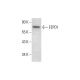 EEPD1 Antibody (B-5) - Western Blotting - Image 300447