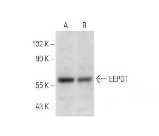 EEPD1 Antibody (B-5) - Western Blotting - Image 305645 